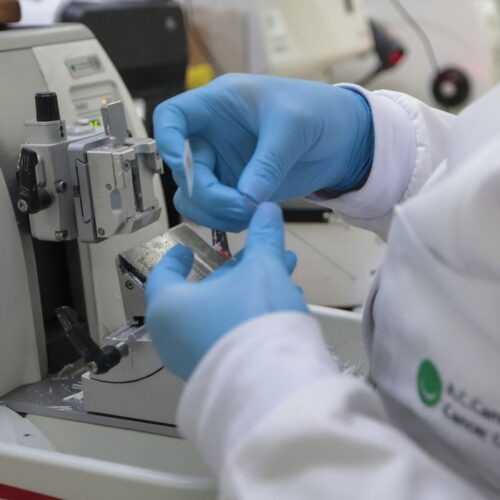 Alerta! “Câncer será a maior causa de mortalidade no Brasil”